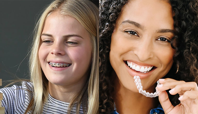 Two females smiling with braces