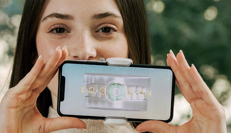 Monitor Dental with Mobile Devices